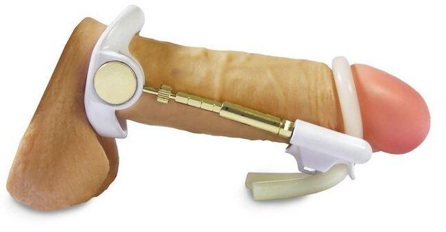 кертмегинин башын чоңойт