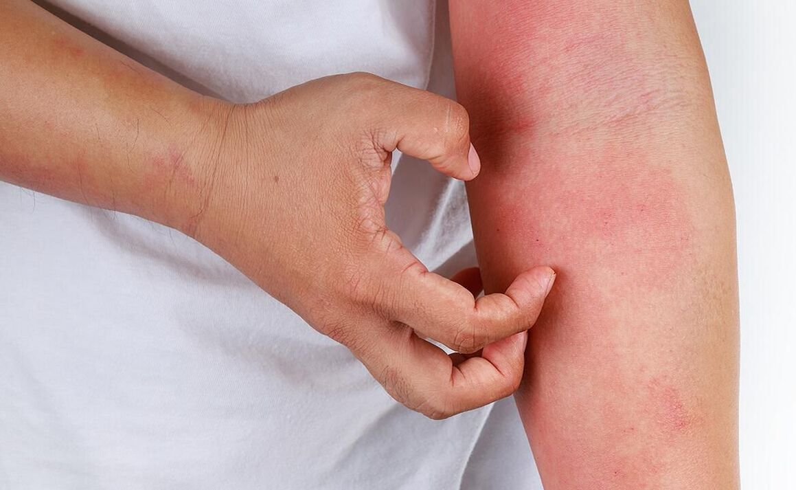 сода колдонуудан мүмкүн болгон кыйынчылыктар